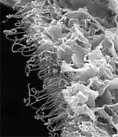 Hydroxyapatit uchycený na upravených nanotrubkách